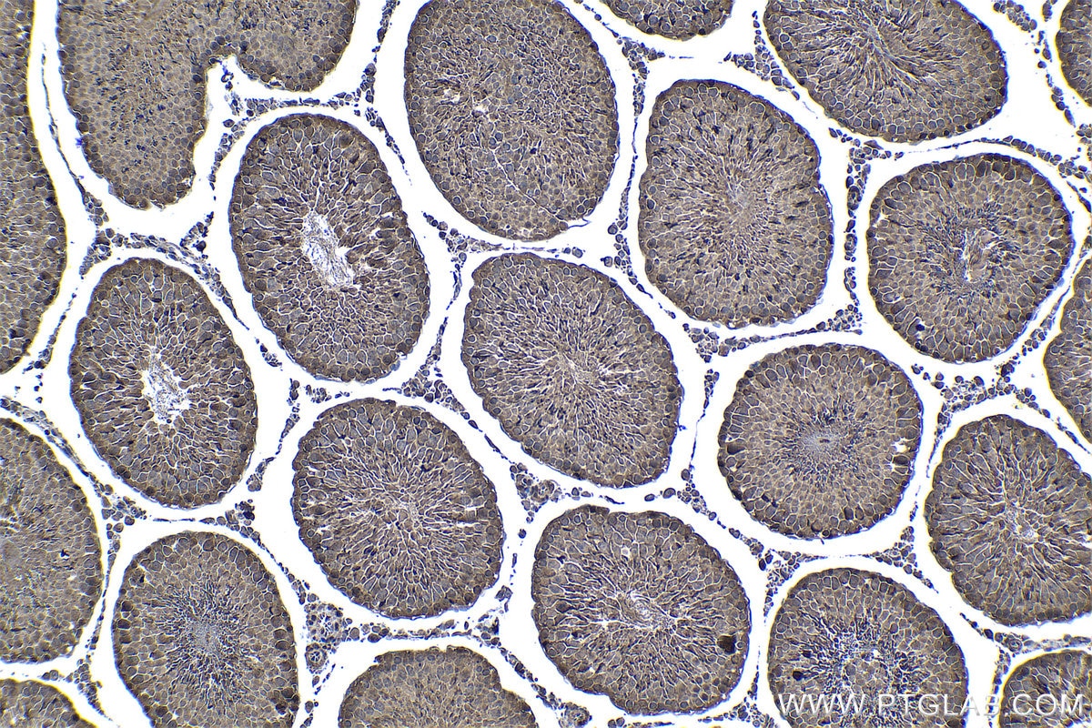 Immunohistochemistry (IHC) staining of rat testis tissue using PSMB5 Polyclonal antibody (19178-1-AP)