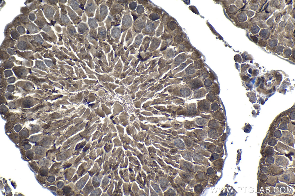 Immunohistochemistry (IHC) staining of rat testis tissue using PSMB5 Polyclonal antibody (19178-1-AP)