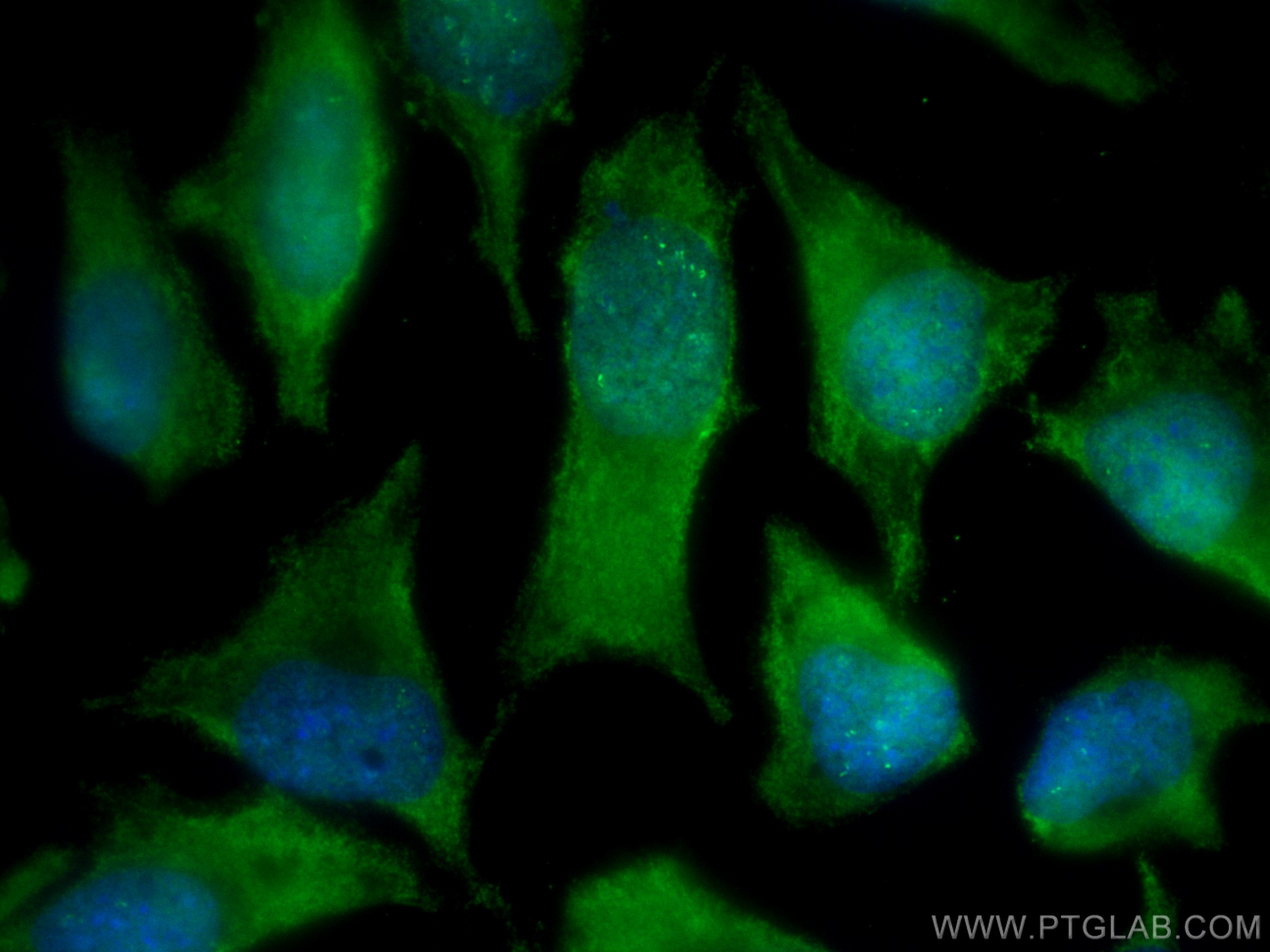 Immunofluorescence (IF) / fluorescent staining of HeLa cells using CoraLite® Plus 488-conjugated PSMB5 Monoclonal ant (CL488-67959)