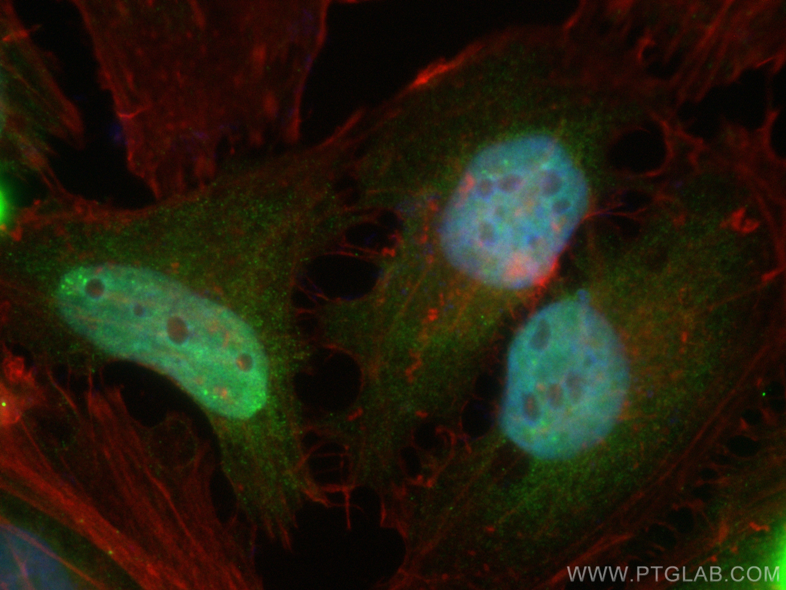 Immunofluorescence (IF) / fluorescent staining of HeLa cells using CoraLite® Plus 488-conjugated PSMB5 Monoclonal ant (CL488-67959)