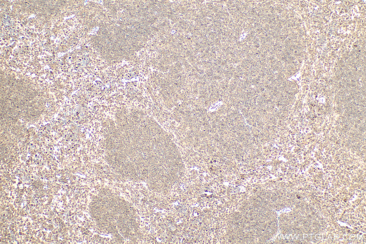 Immunohistochemistry (IHC) staining of mouse spleen tissue using PSMB8 Polyclonal antibody (14859-1-AP)