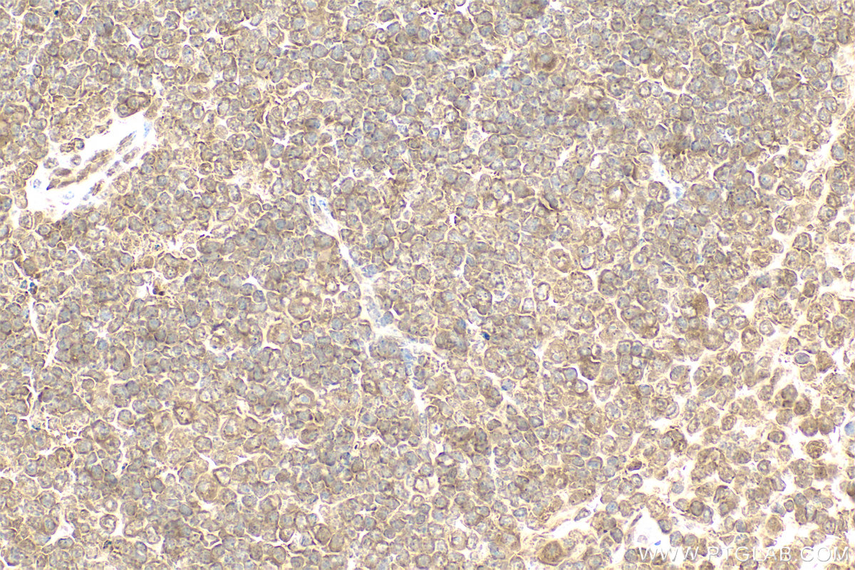 Immunohistochemistry (IHC) staining of mouse spleen tissue using PSMB8 Polyclonal antibody (14859-1-AP)