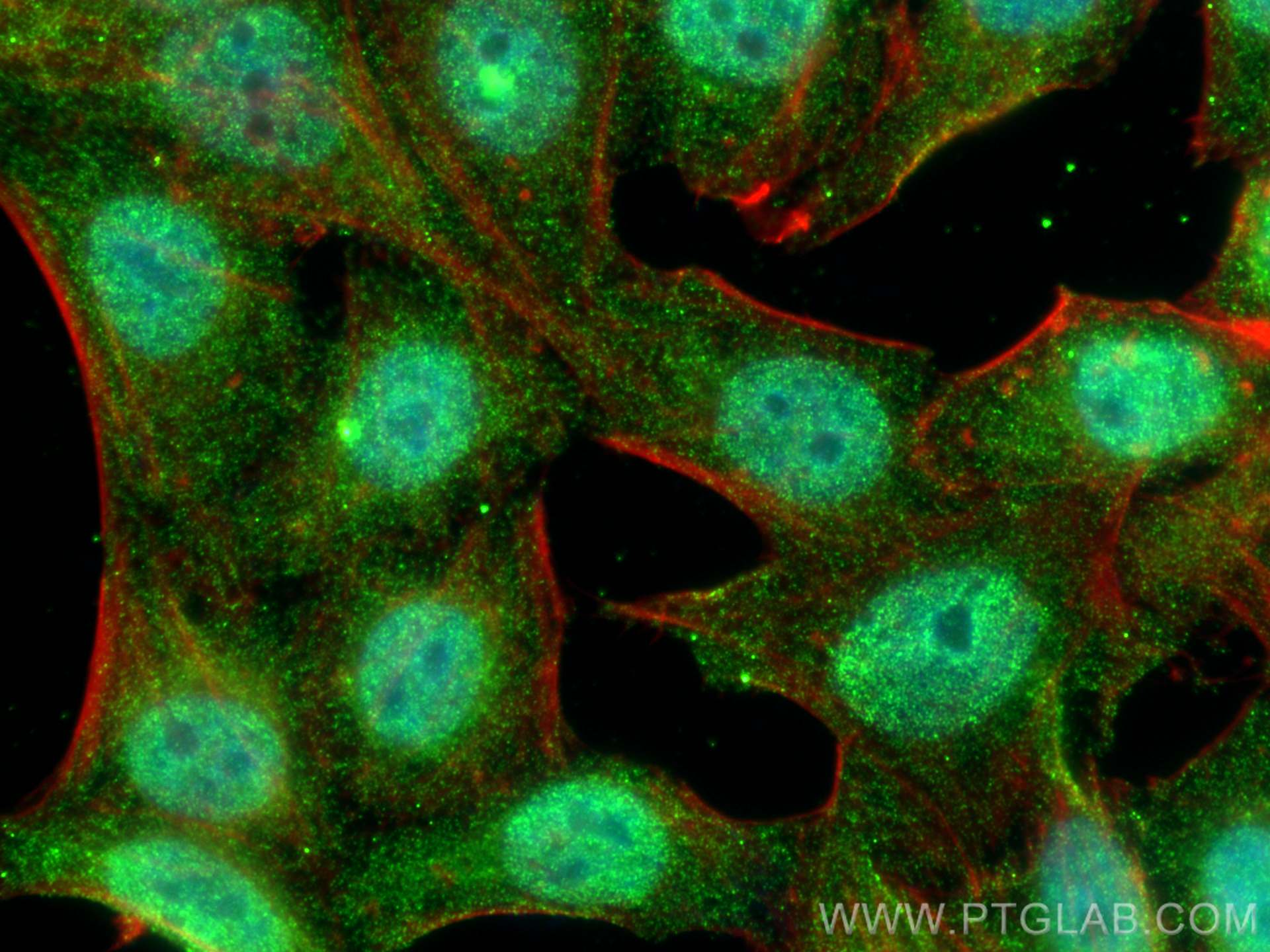 Immunofluorescence (IF) / fluorescent staining of HepG2 cells using PSMB8 Monoclonal antibody (66759-1-Ig)