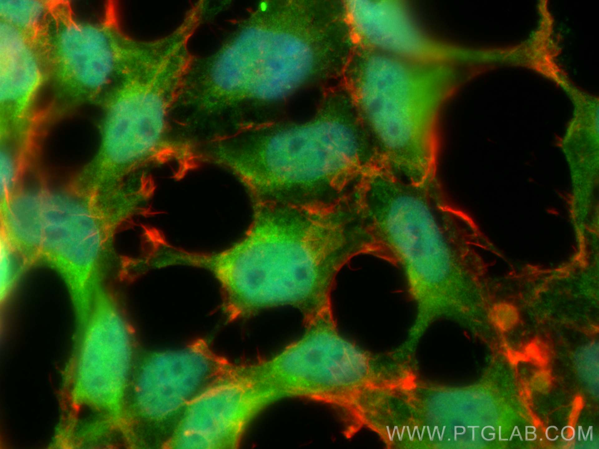 Immunofluorescence (IF) / fluorescent staining of HEK-293 cells using PSMC3 Polyclonal antibody (24142-1-AP)