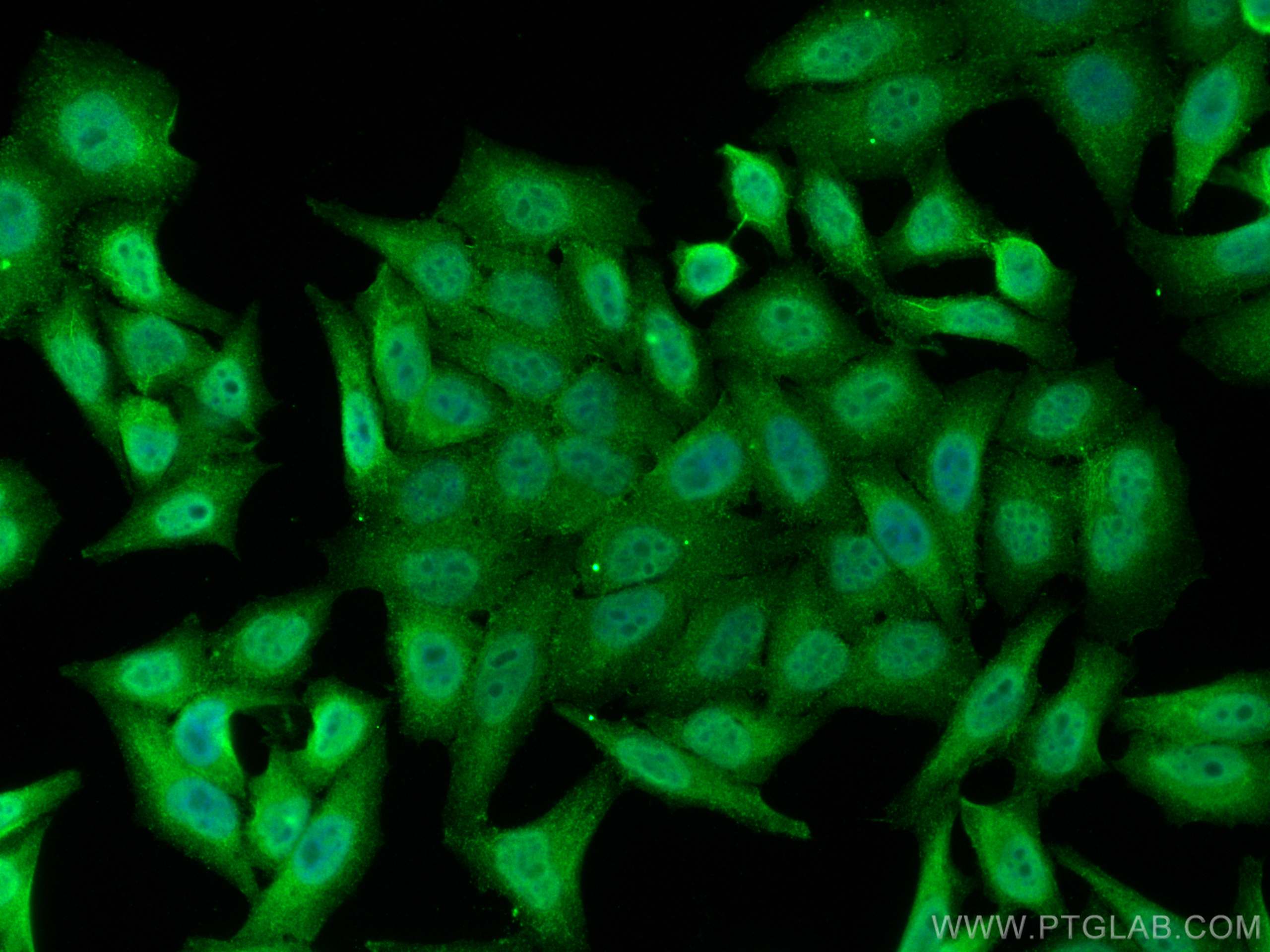 Immunofluorescence (IF) / fluorescent staining of HepG2 cells using HOP2 Polyclonal antibody (11339-1-AP)