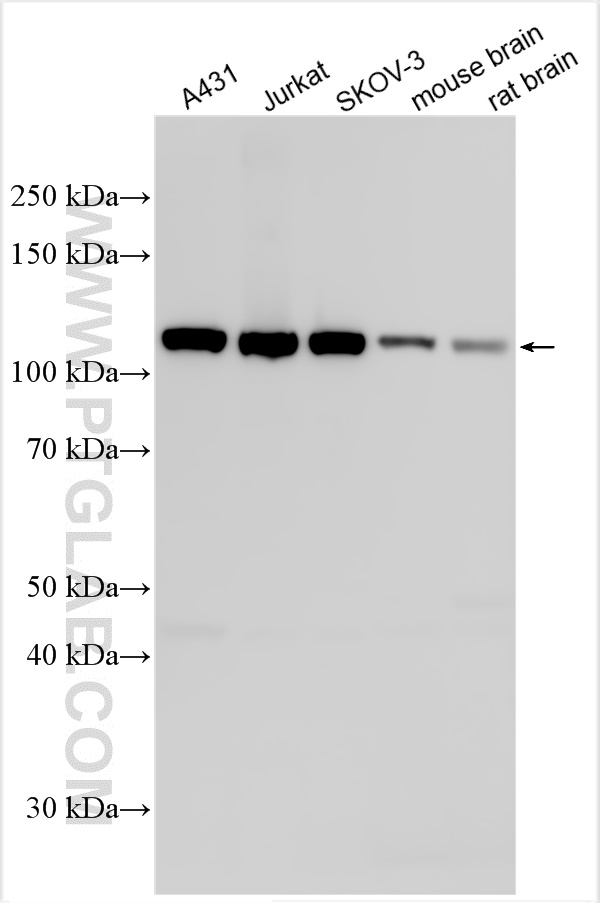 Western Blot (WB) analysis of various lysates using PSMD1 Polyclonal antibody (31912-1-AP)