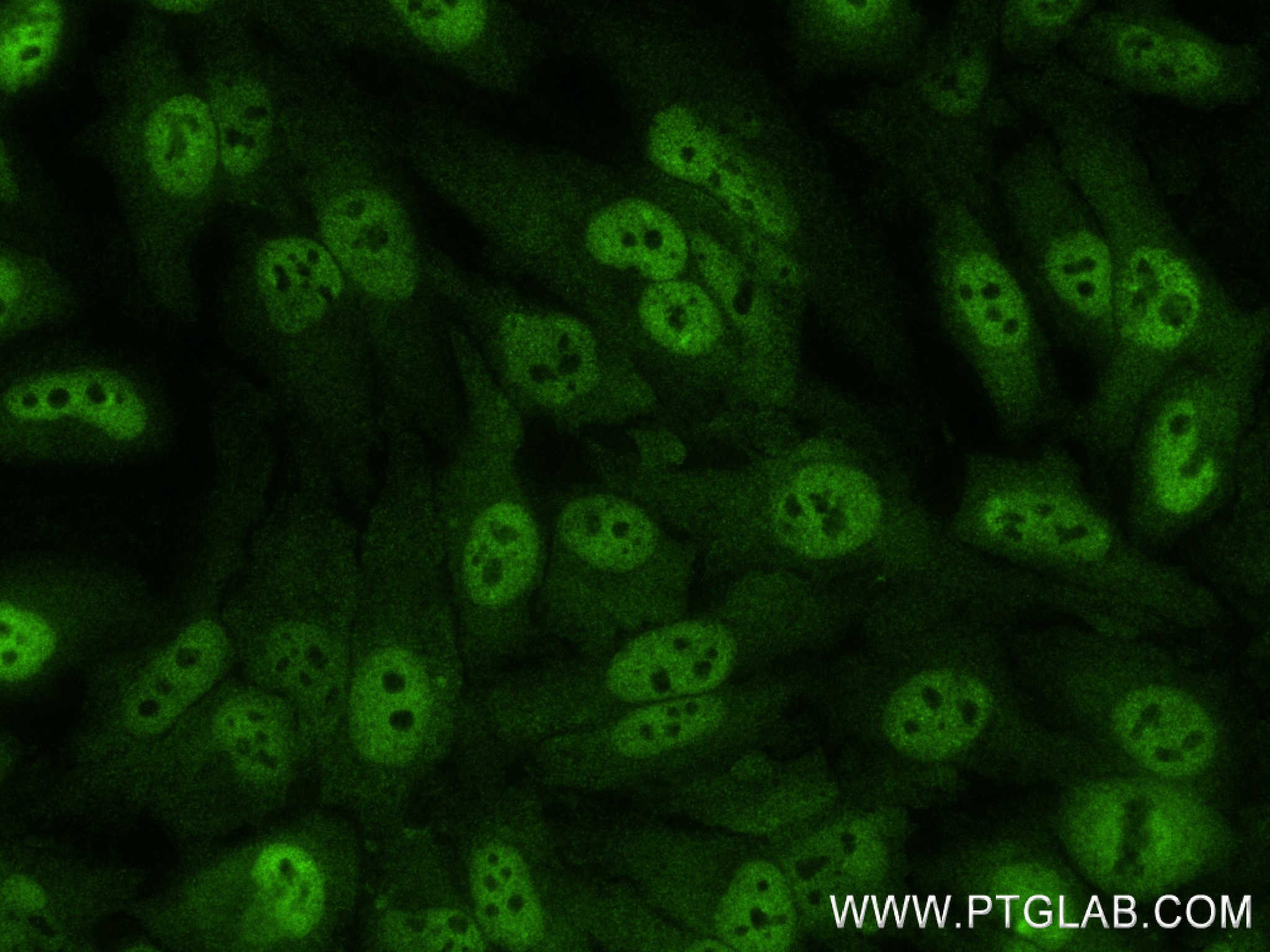 Immunofluorescence (IF) / fluorescent staining of HeLa cells using PSMD1 Recombinant antibody (83521-4-RR)