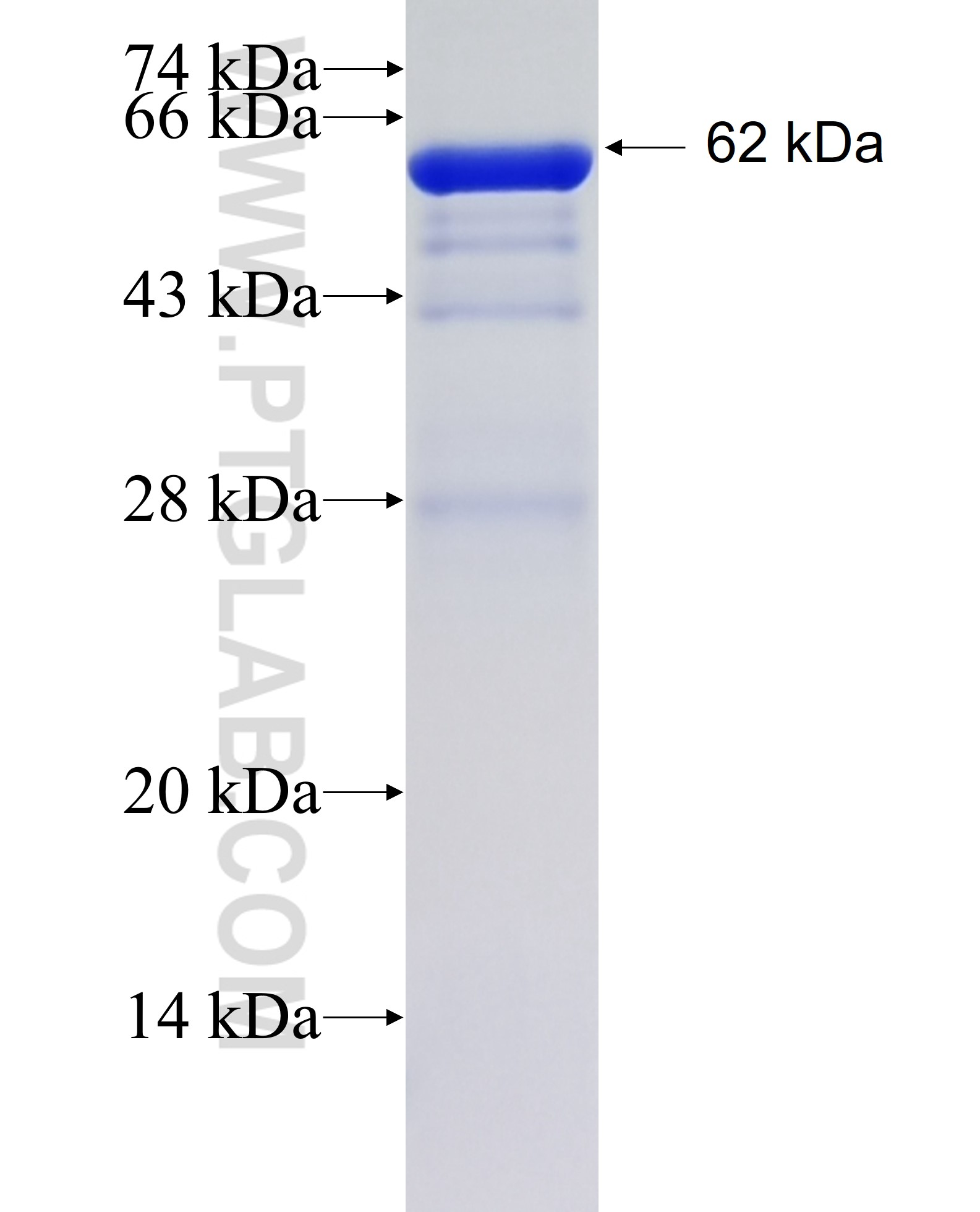 PSMD1 fusion protein Ag36142 SDS-PAGE