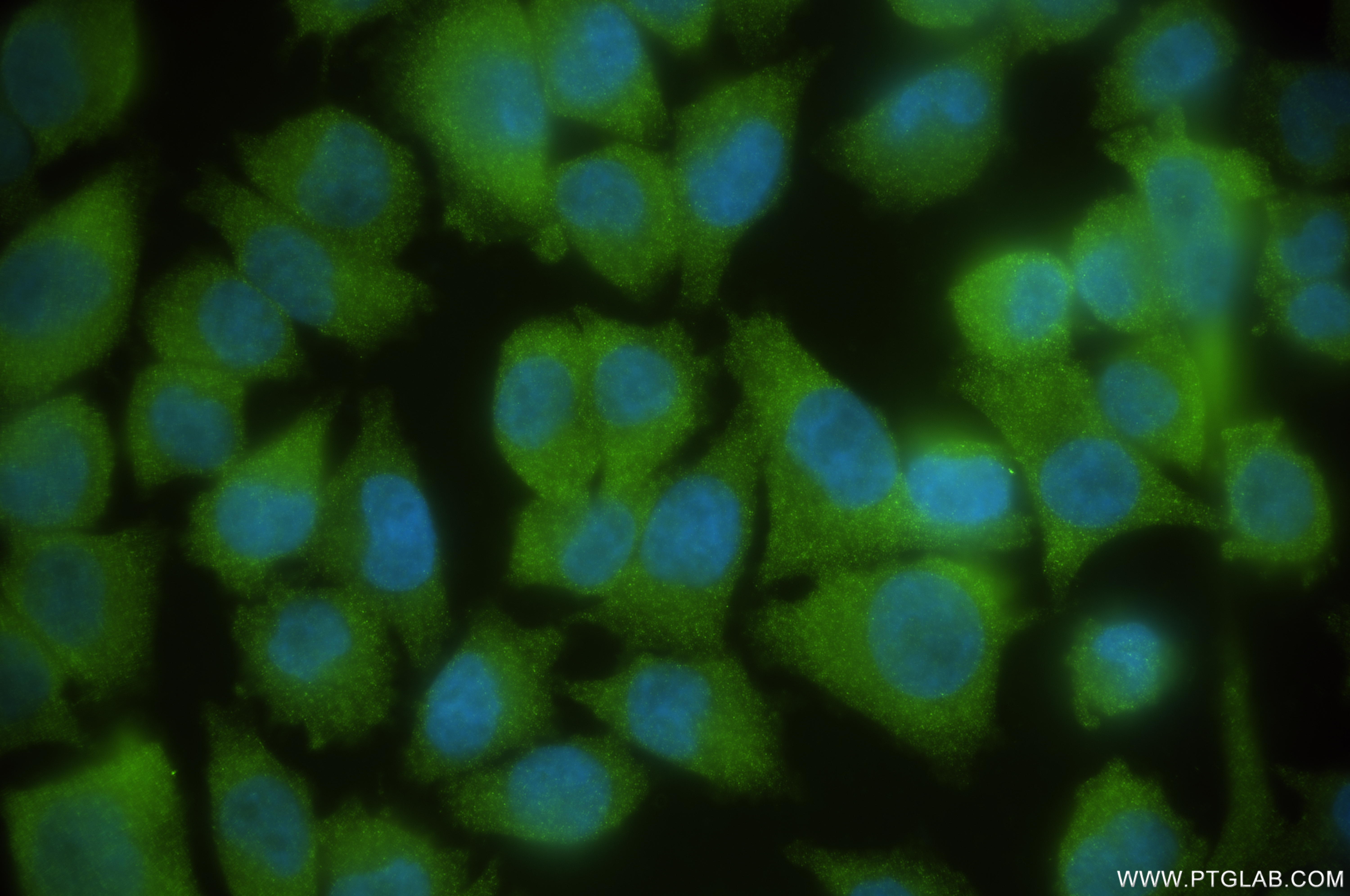 Immunofluorescence (IF) / fluorescent staining of A375 cells using PSMD14/POH1 Recombinant antibody (84767-3-RR)