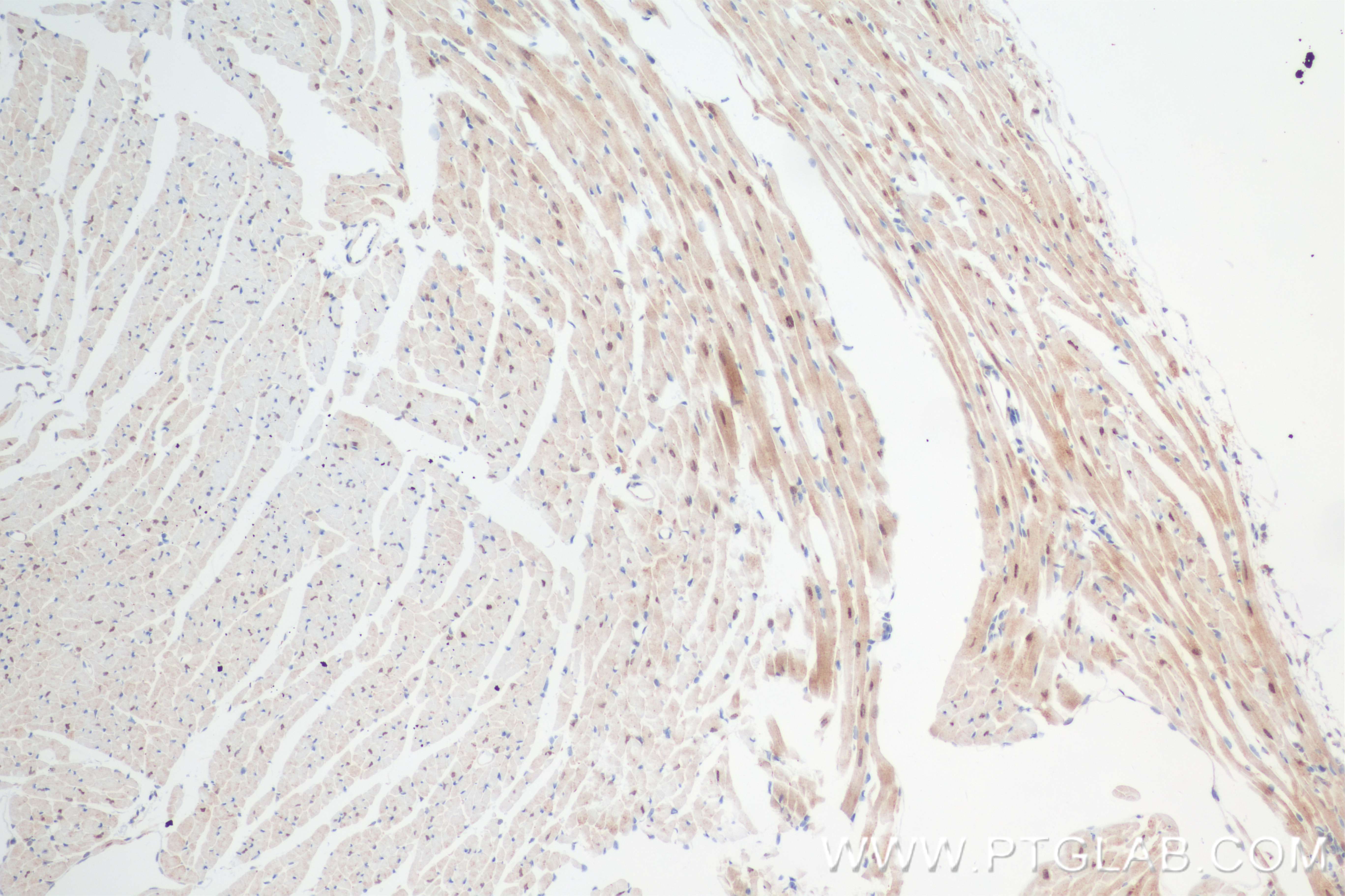 Immunohistochemistry (IHC) staining of mouse heart tissue using PSMD14/POH1 Recombinant antibody (84767-3-RR)