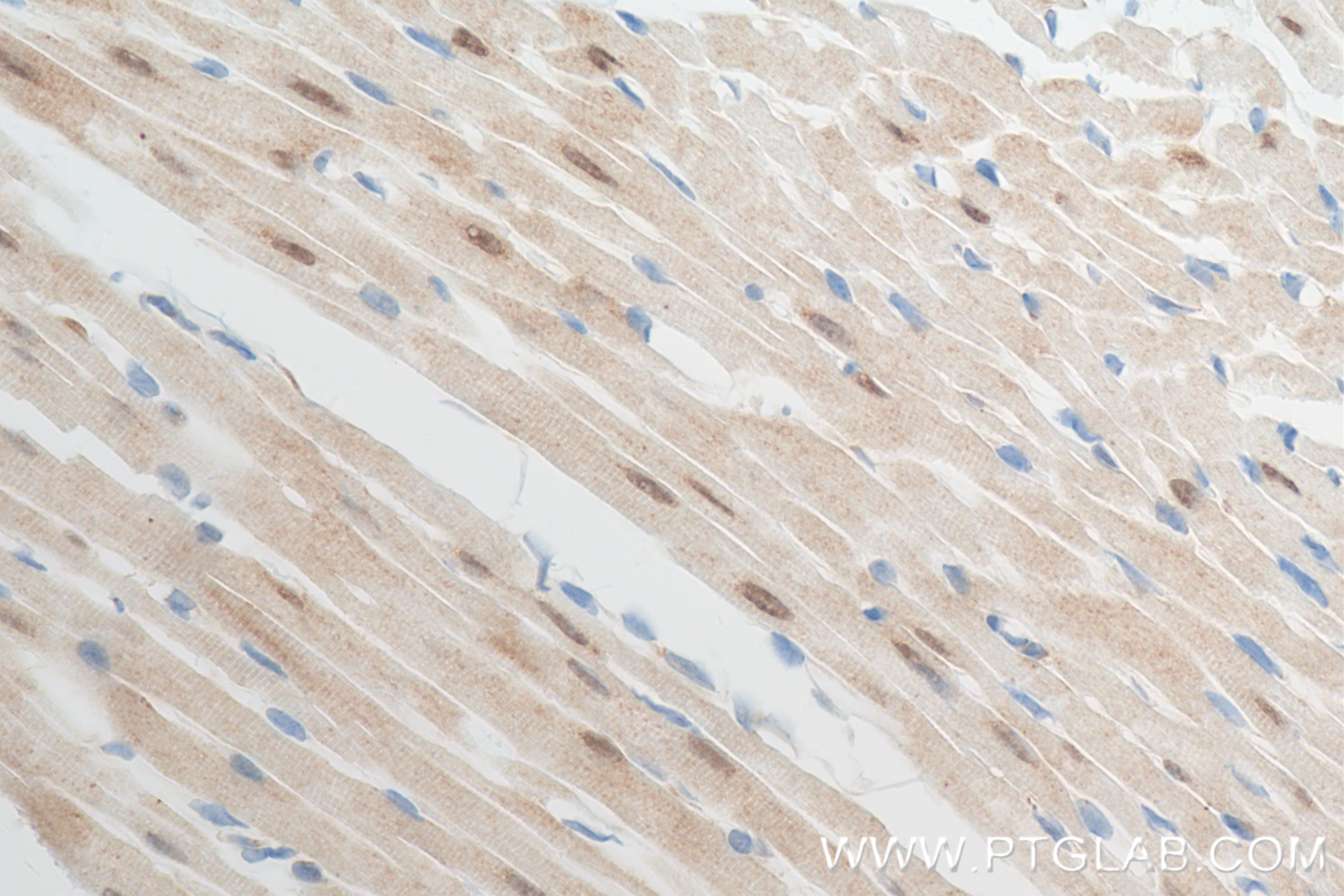 Immunohistochemistry (IHC) staining of mouse heart tissue using PSMD14/POH1 Recombinant antibody (84767-3-RR)