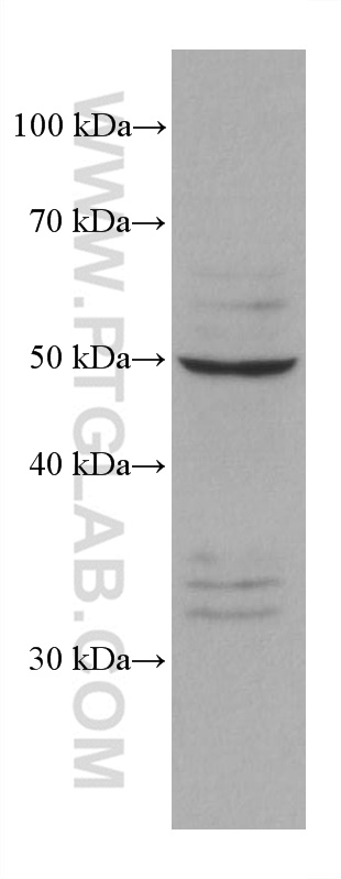 Western Blot (WB) analysis of K-562 cells using PSMD5 Monoclonal antibody (67682-1-Ig)