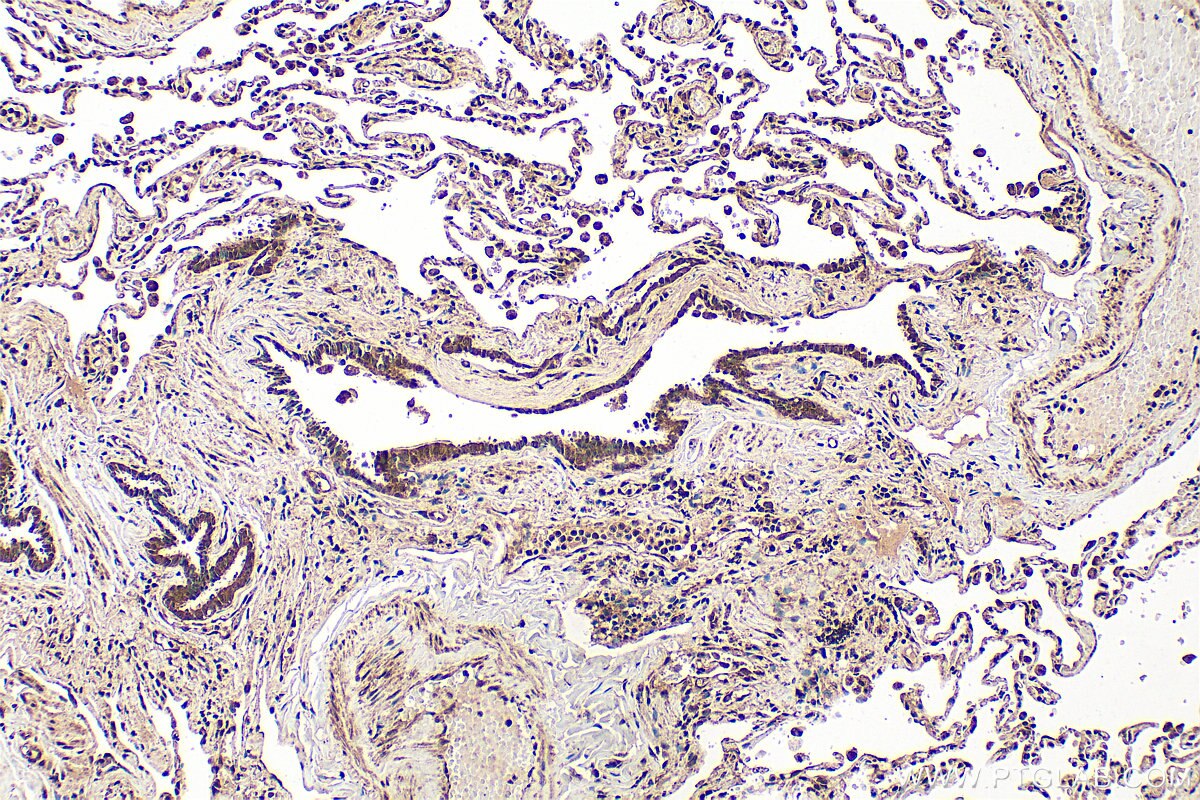 Immunohistochemistry (IHC) staining of human lung tissue using PSMD7 Polyclonal antibody (16034-1-AP)