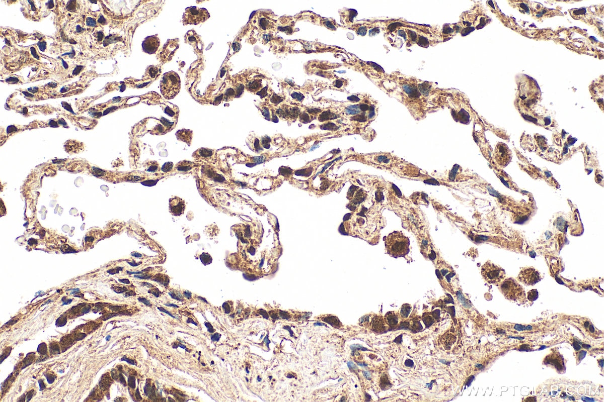 Immunohistochemistry (IHC) staining of human lung tissue using PSMD7 Polyclonal antibody (16034-1-AP)