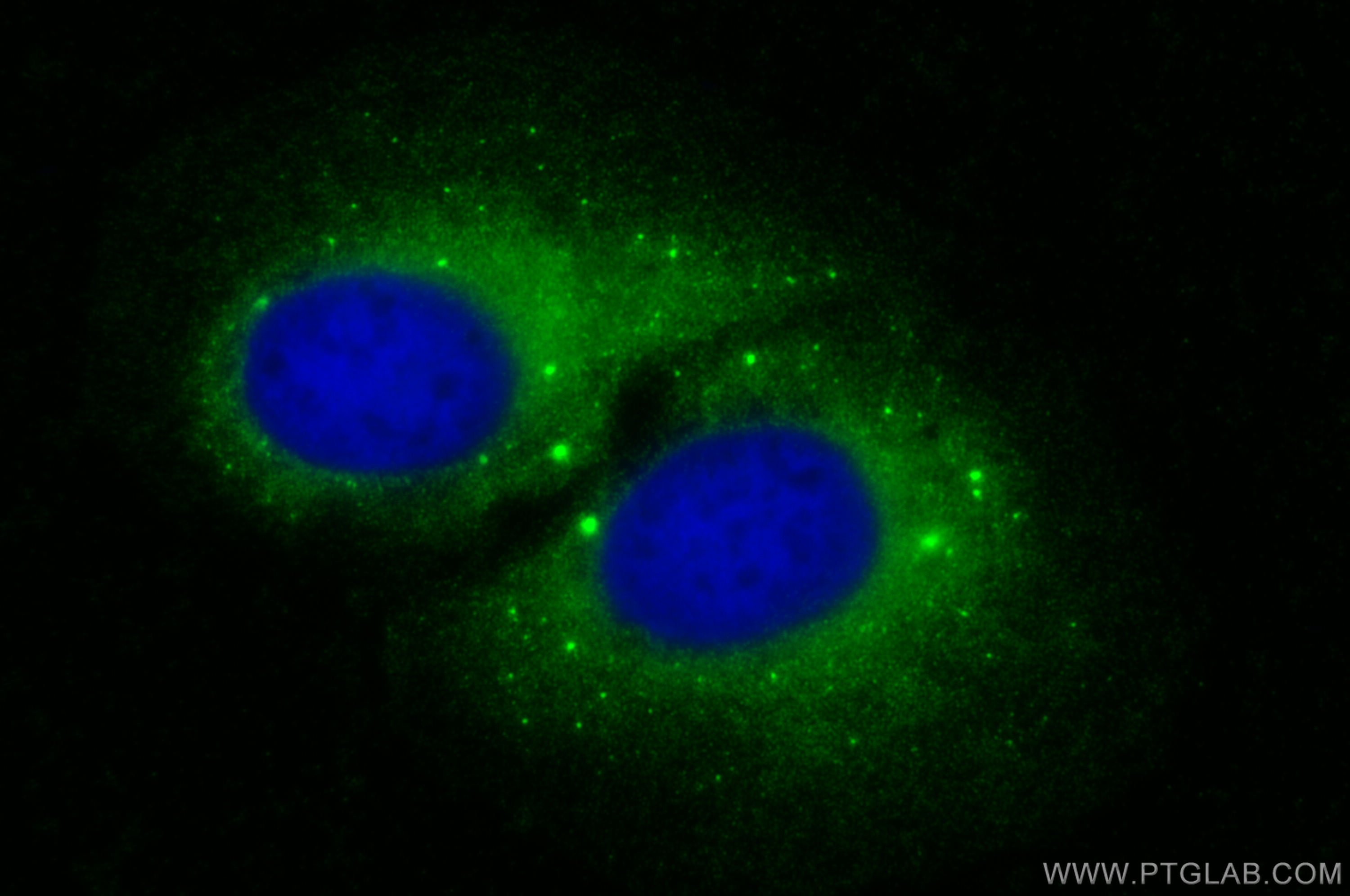 Immunofluorescence (IF) / fluorescent staining of U2OS cells using PSMD8 Polyclonal antibody (27504-1-AP)