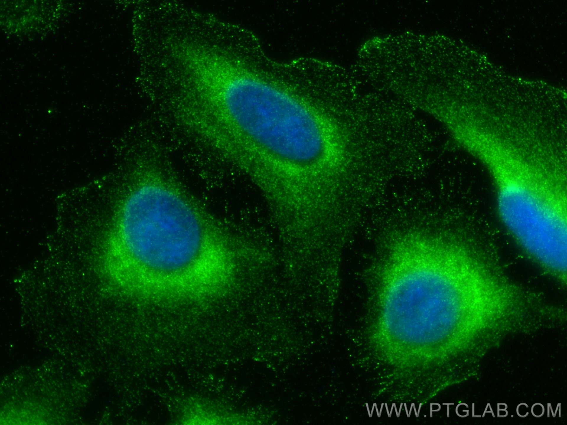 Immunofluorescence (IF) / fluorescent staining of U2OS cells using PSMD9 Polyclonal antibody (26922-1-AP)