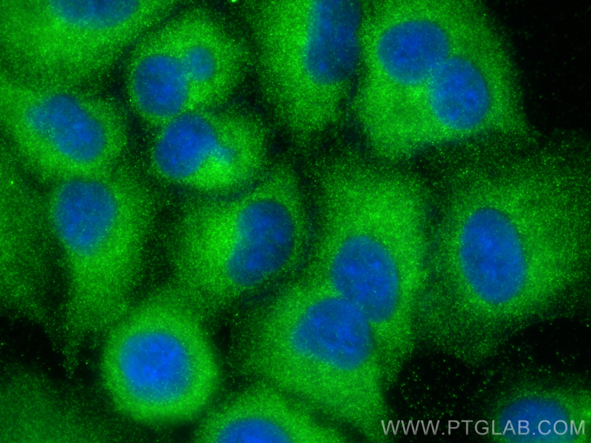 Immunofluorescence (IF) / fluorescent staining of A549 cells using PSMD9 Polyclonal antibody (26922-1-AP)