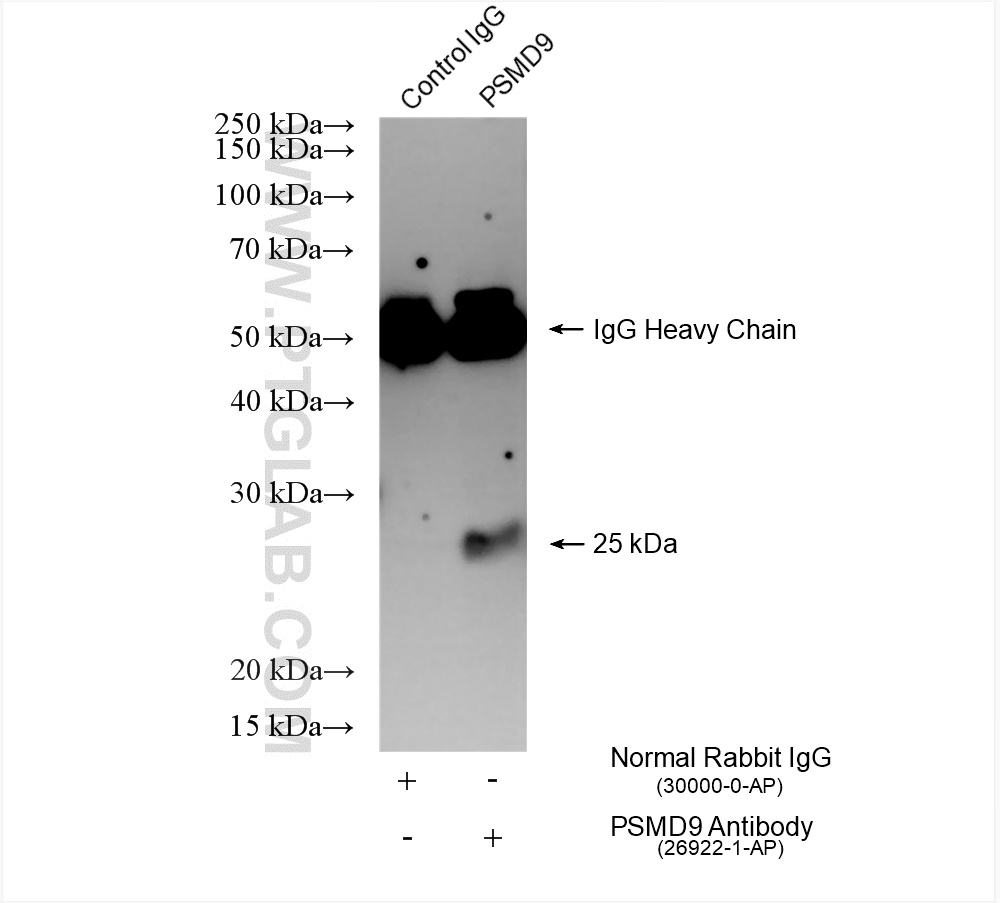 Immunoprecipitation (IP) experiment of A549 cells using PSMD9 Polyclonal antibody (26922-1-AP)