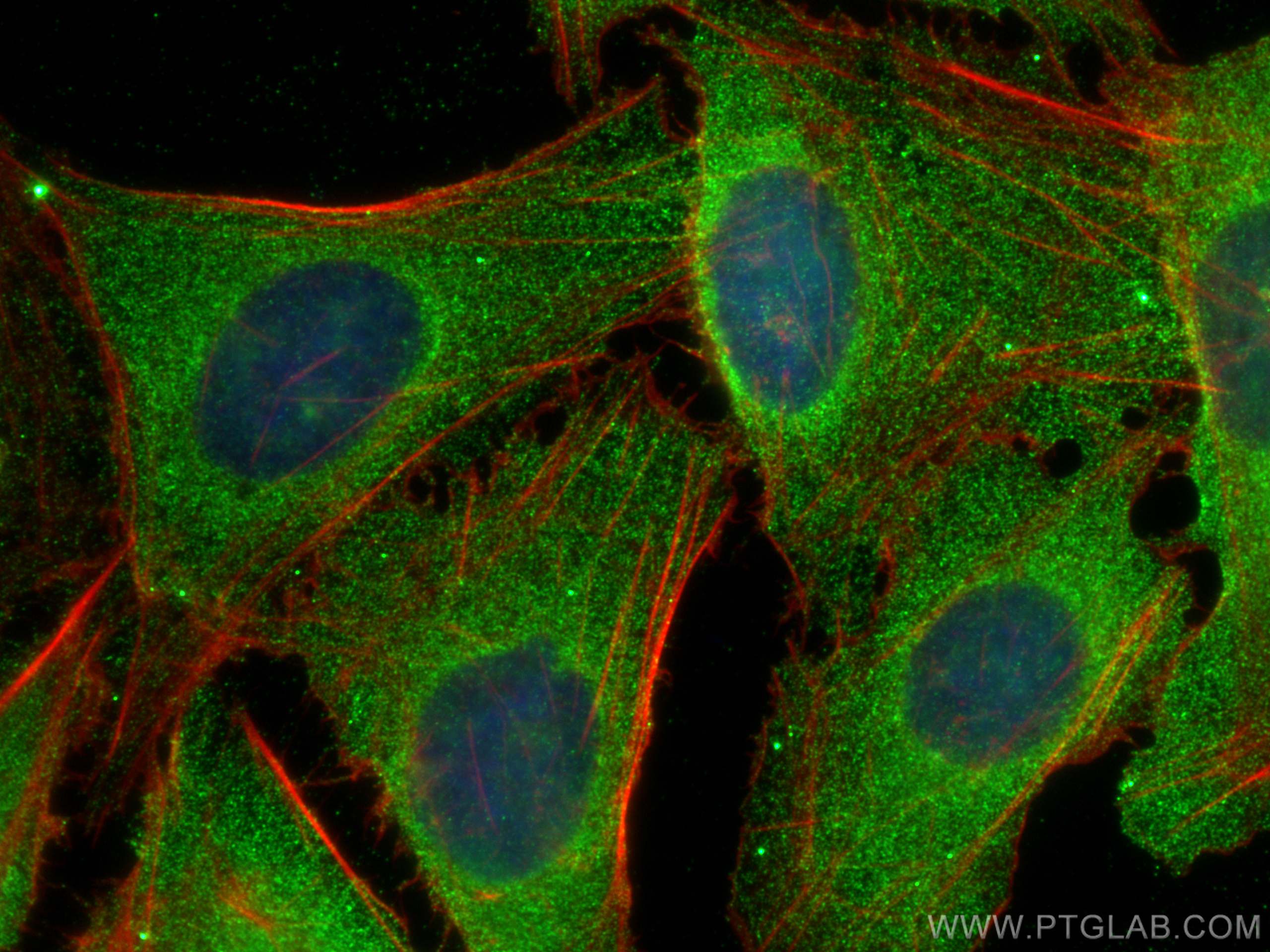 Immunofluorescence (IF) / fluorescent staining of U2OS cells using PSMD9 Monoclonal antibody (67338-1-Ig)