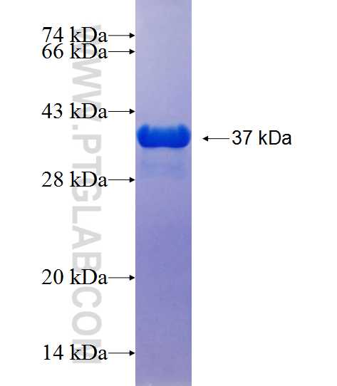 PSMD9 fusion protein Ag25638 SDS-PAGE