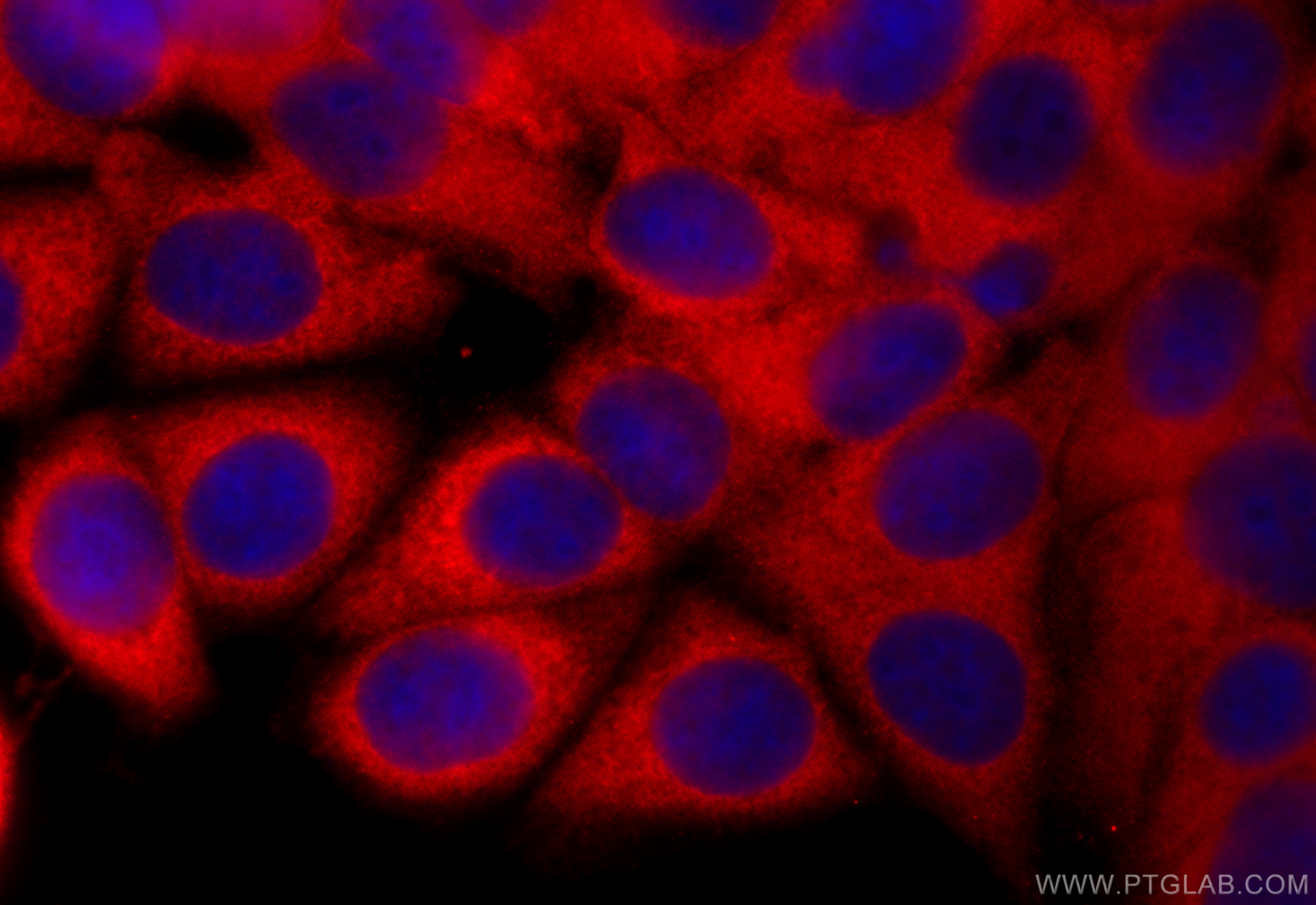 Immunofluorescence (IF) / fluorescent staining of MCF-7 cells using PSME2 Polyclonal antibody (12937-2-AP)