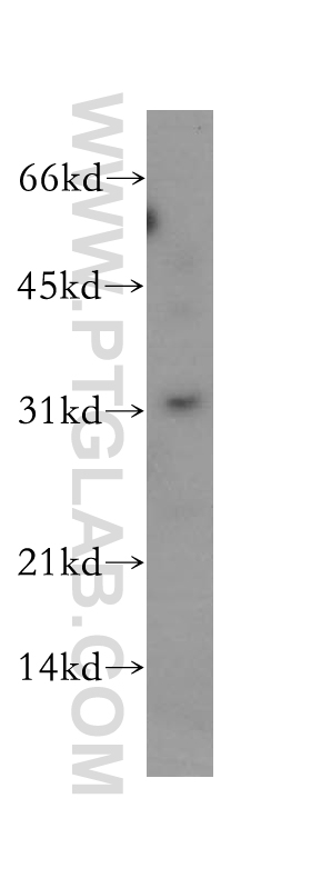 Western Blot (WB) analysis of human kidney tissue using PSMF1 Polyclonal antibody (12941-1-AP)