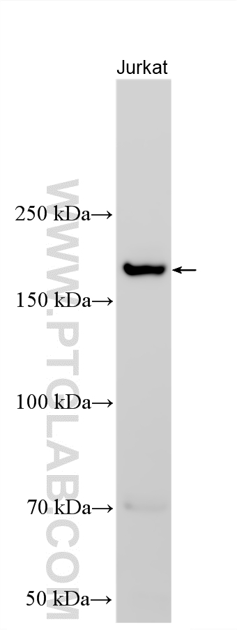 Western Blot (WB) analysis of various lysates using PTCH1 Polyclonal antibody (17520-1-AP)