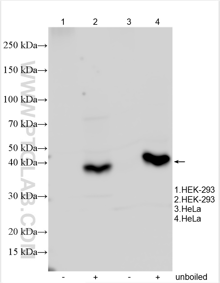 Ptdss Antibody Ap Proteintech