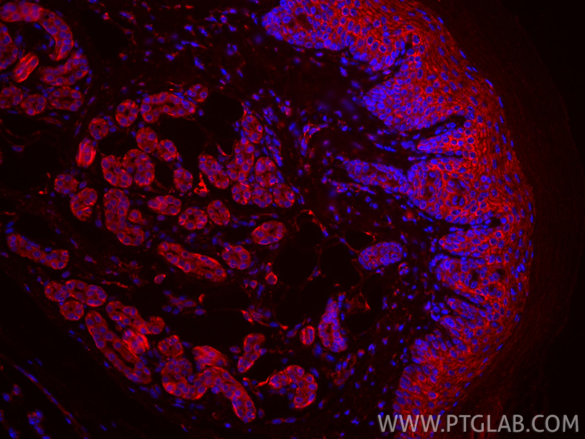 Immunofluorescence (IF) / fluorescent staining of mouse skin tissue using CoraLite®594-conjugated PTGER4 Monoclonal antibody (CL594-66921)