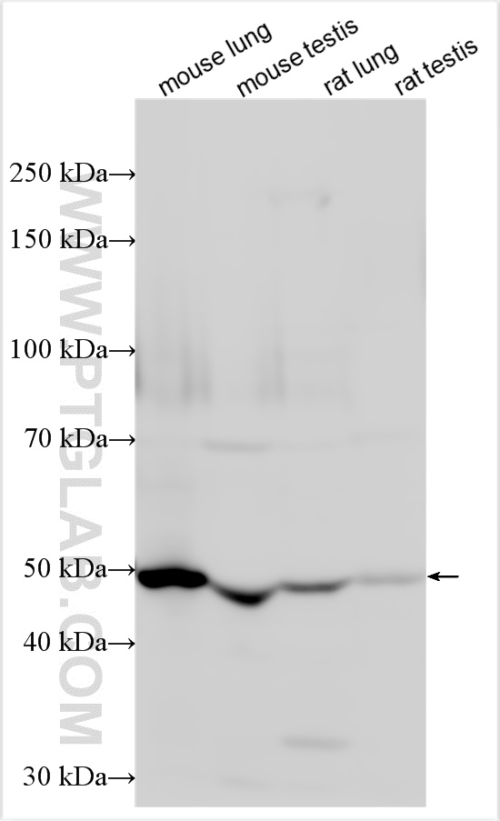 Western Blot (WB) analysis of various lysates using PTGIS Polyclonal antibody (27061-1-AP)