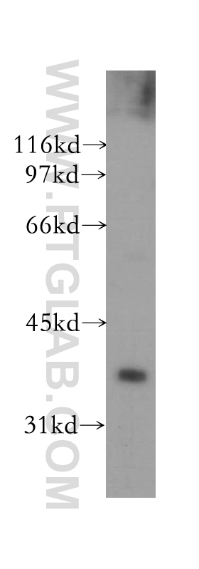 Western Blot (WB) analysis of HeLa cells using PTGR1 Polyclonal antibody (13374-1-AP)