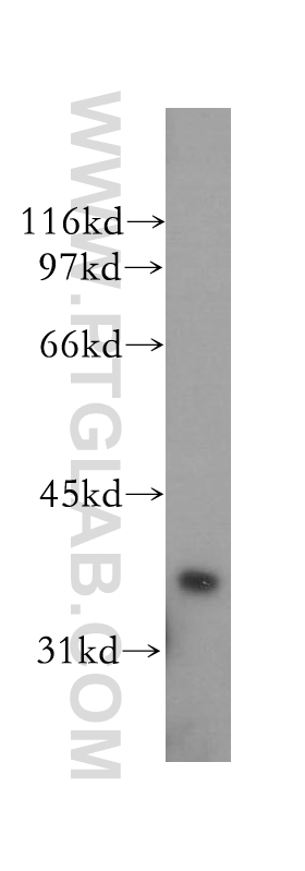 Western Blot (WB) analysis of human colon tissue using PTGR1 Polyclonal antibody (13374-1-AP)