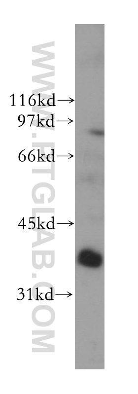 Western Blot (WB) analysis of human liver tissue using PTGR1 Polyclonal antibody (13374-1-AP)