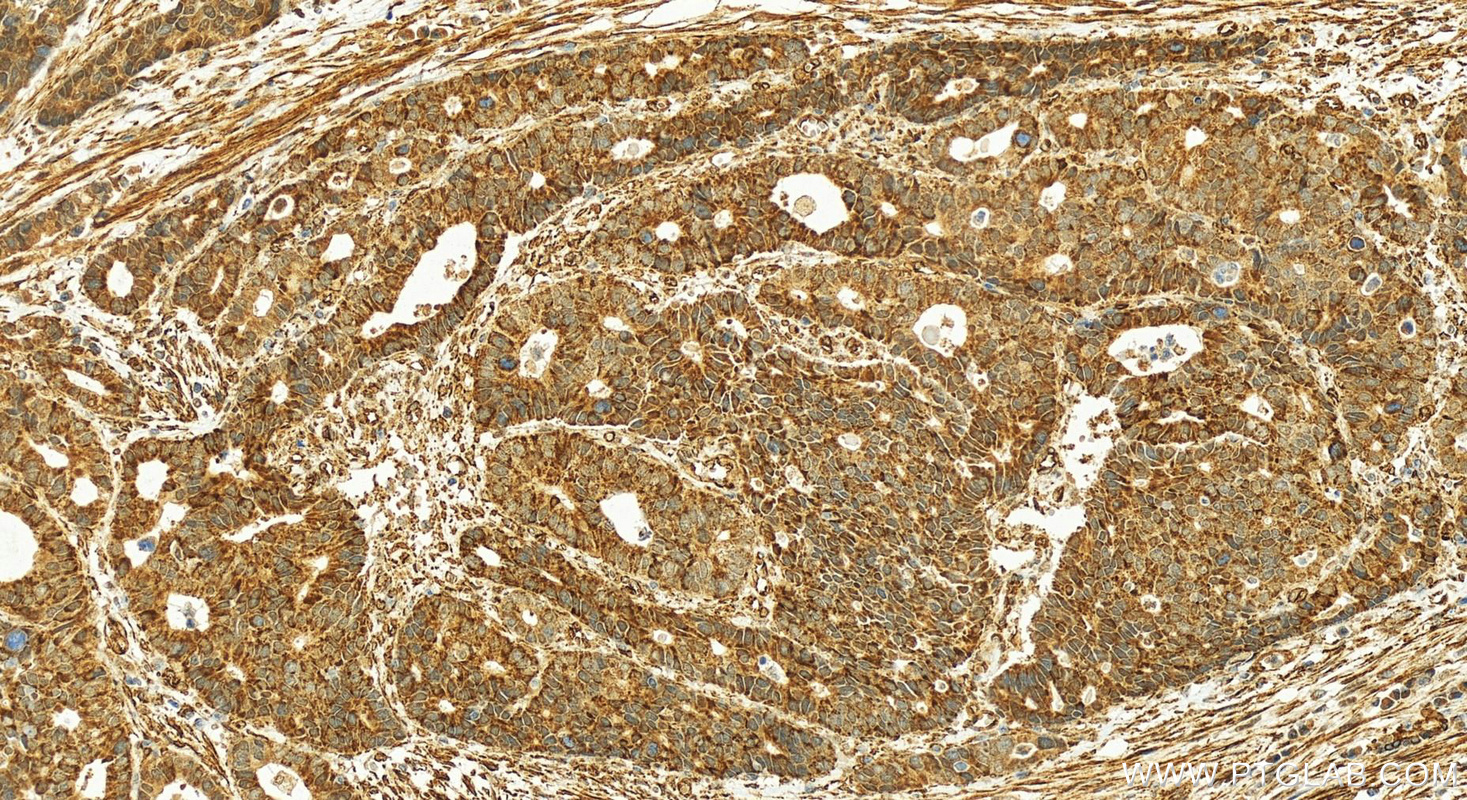 Immunohistochemistry (IHC) staining of human stomach tissue using COX-1/Cyclooxygenase-1 Polyclonal antibody (13393-1-AP)