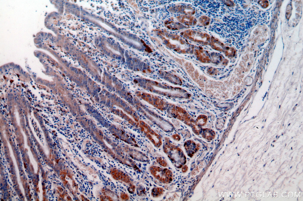 COX-1/Cyclooxygenase-1