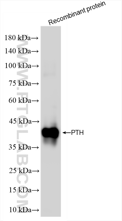 Western Blot (WB) analysis of Recombinant protein using PTH Recombinant antibody (84960-4-RR)