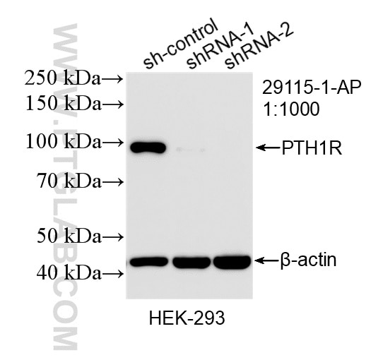Western Blot (WB) analysis of HEK-293 cells using PTH1R Polyclonal antibody (29115-1-AP)