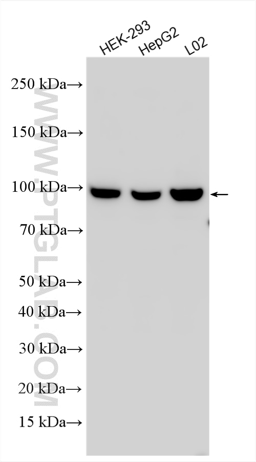 Western Blot (WB) analysis of various lysates using PTH1R Polyclonal antibody (29115-1-AP)