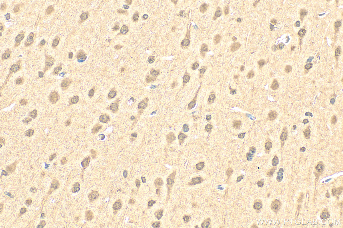 Immunohistochemistry (IHC) staining of rat brain tissue using PYK2 Polyclonal antibody (17592-1-AP)