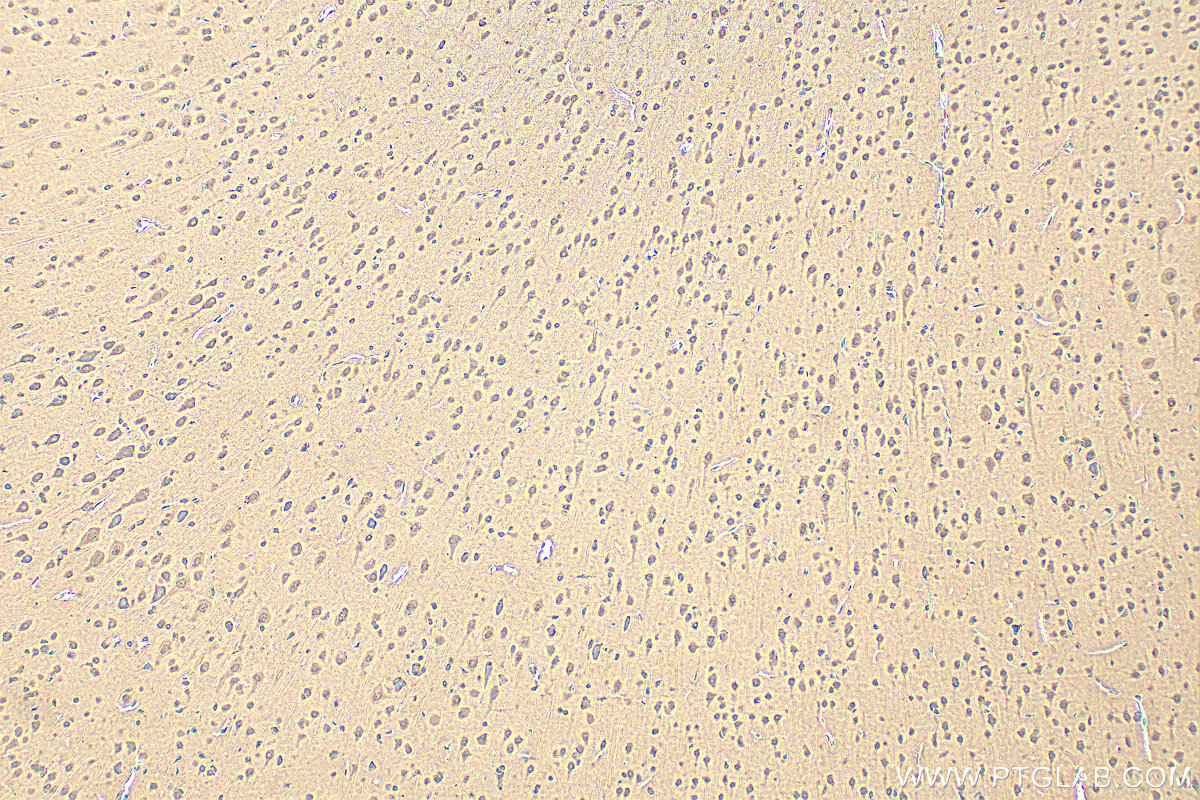 Immunohistochemistry (IHC) staining of rat brain tissue using PYK2 Polyclonal antibody (17592-1-AP)