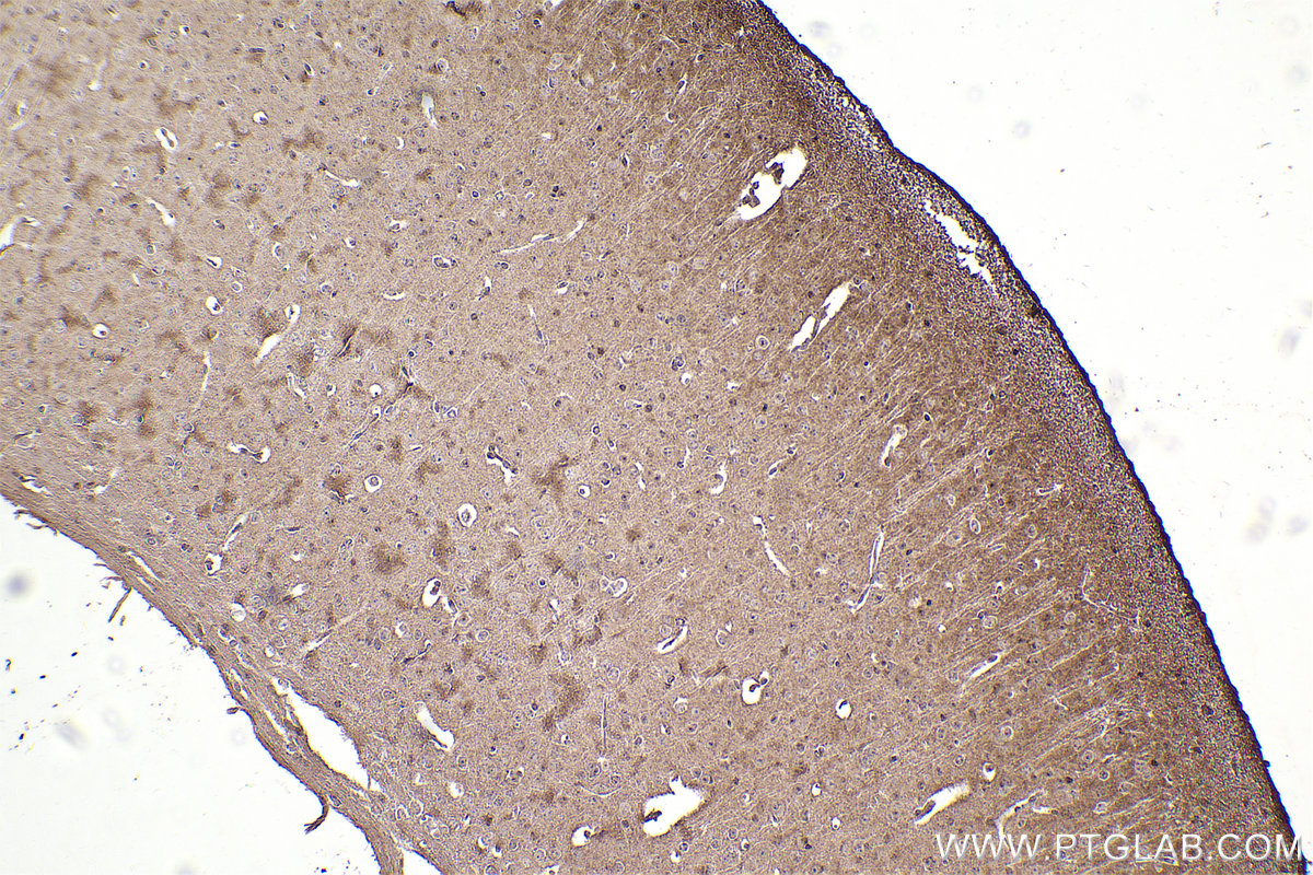 Immunohistochemistry (IHC) staining of mouse brain tissue using PTK2B Monoclonal antibody (67141-1-Ig)