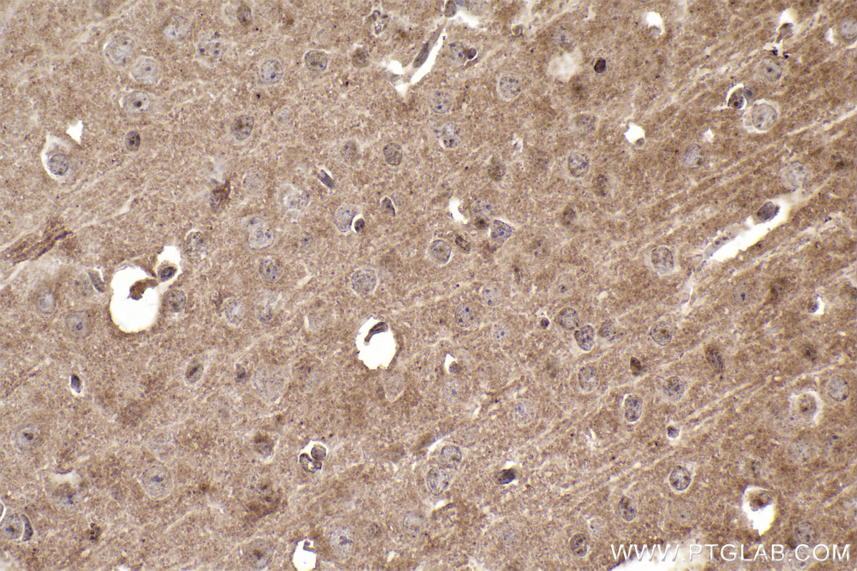 Immunohistochemistry (IHC) staining of mouse brain tissue using PTK2B Monoclonal antibody (67141-1-Ig)