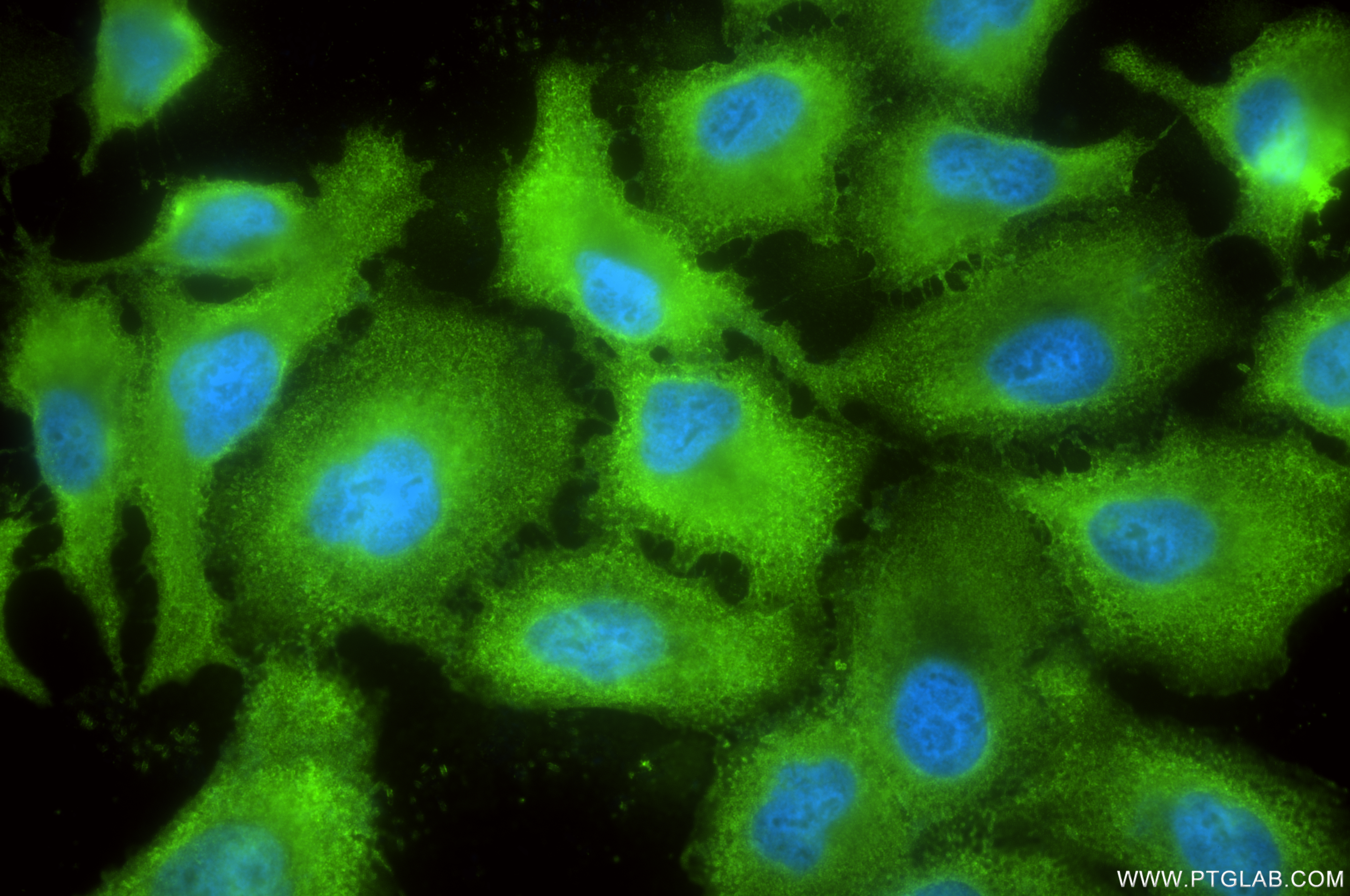 Immunofluorescence (IF) / fluorescent staining of A549 cells using PTK6/BRK Recombinant antibody (85352-2-RR)