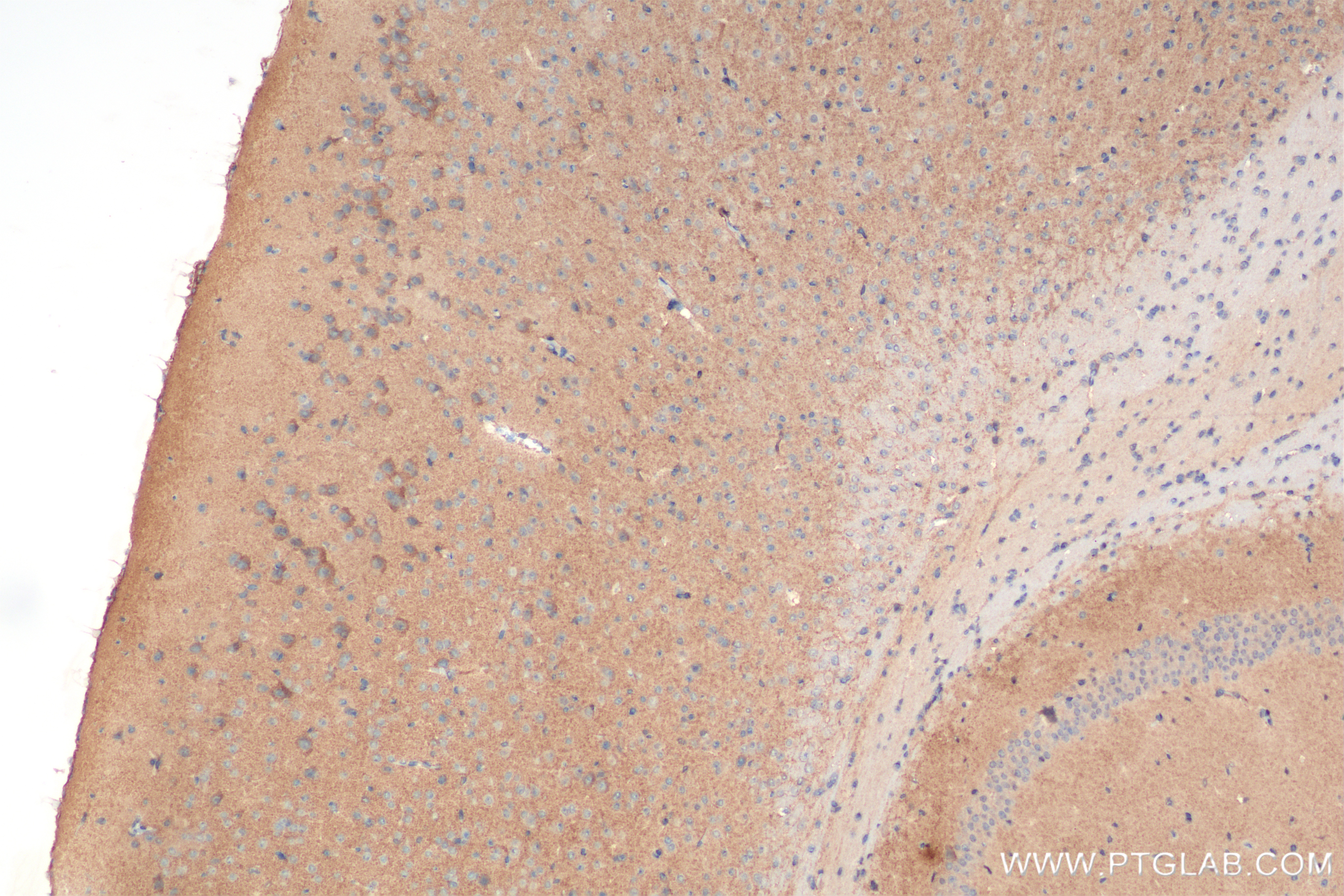 Immunohistochemistry (IHC) staining of mouse brain tissue using PTK7 Recombinant antibody (85075-1-RR)