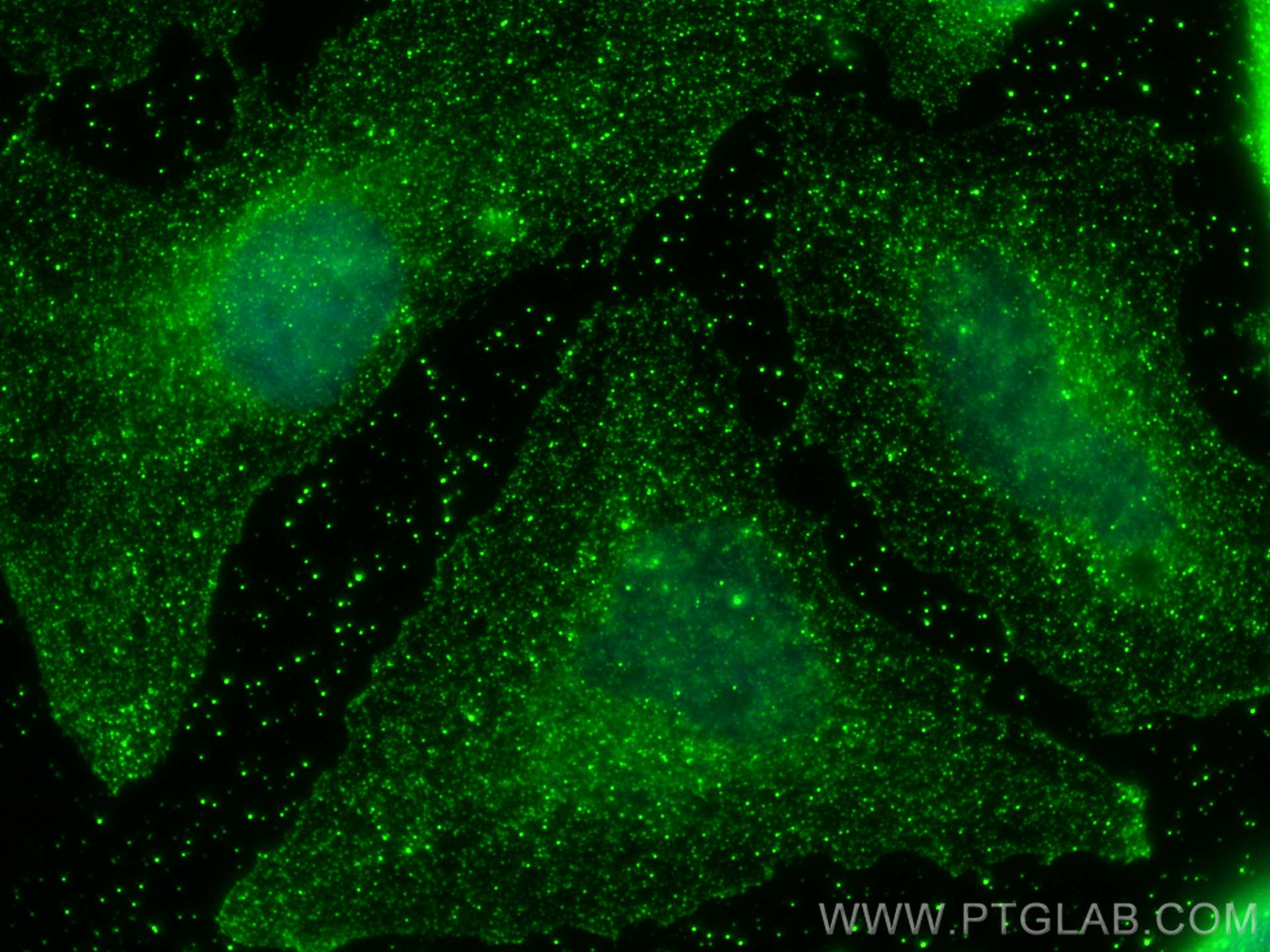 Immunofluorescence (IF) / fluorescent staining of HeLa cells using PTP4A1 Monoclonal antibody (67584-1-Ig)