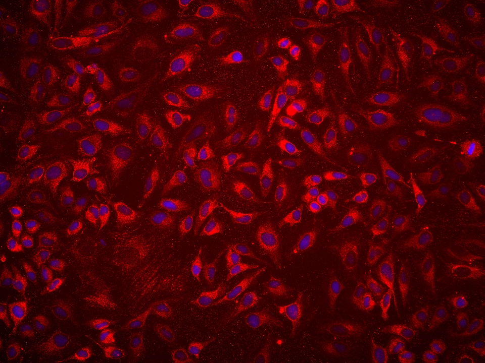 Immunofluorescence (IF) / fluorescent staining of HeLa cells using PTPIP51 Monoclonal antibody (68582-1-Ig)