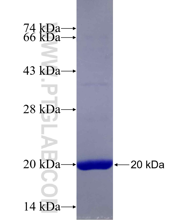 PTPLAD1 fusion protein Ag29578 SDS-PAGE