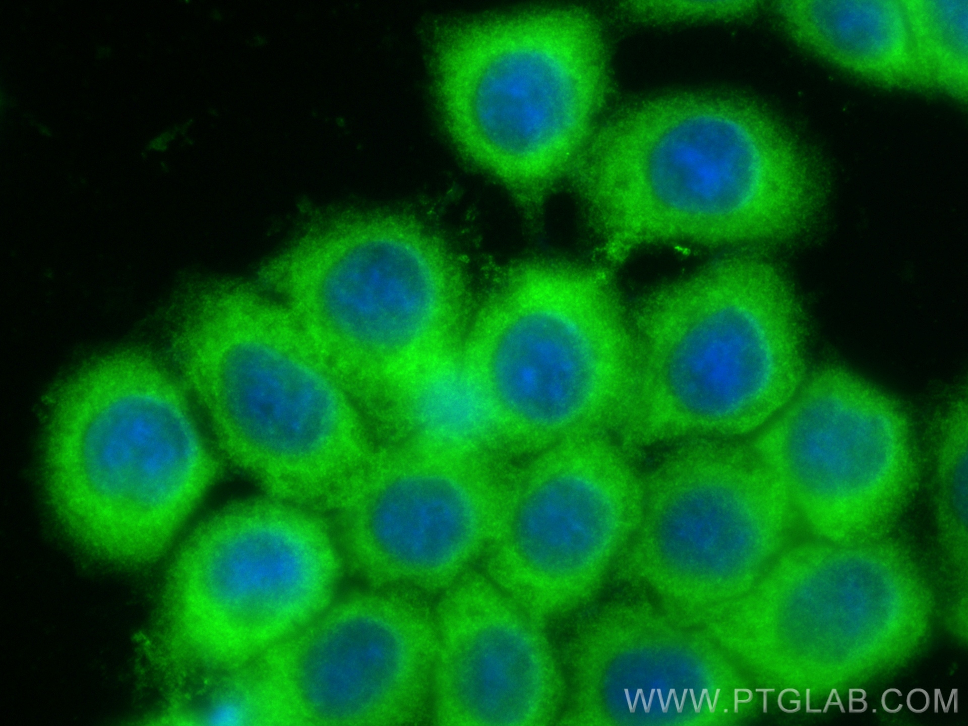 Immunofluorescence (IF) / fluorescent staining of BxPC-3 cells using PTP1B Polyclonal antibody (11334-1-AP)