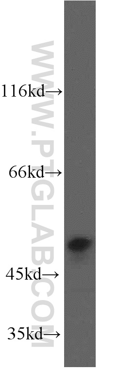PTP1B Polyclonal antibody