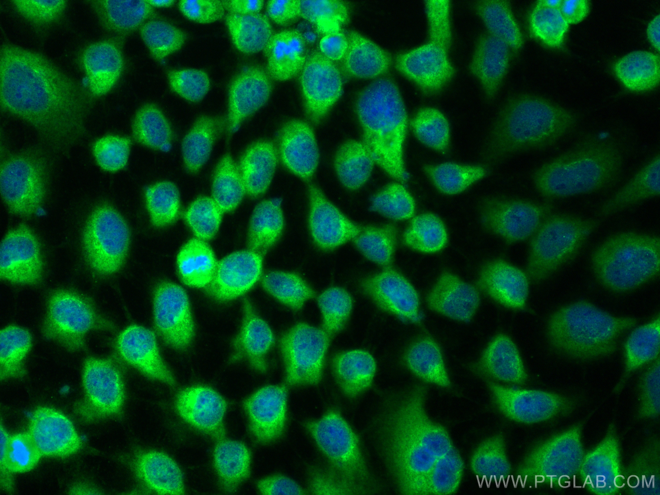 Immunofluorescence (IF) / fluorescent staining of A431 cells using PTPN12 Polyclonal antibody (31215-1-AP)